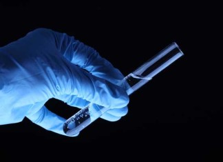 Post-Ebola Syndrome: Surviving Is Not Enough