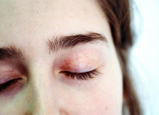 Saying Goodbye to Aging, Wrinkled Skin: 3 Non-Surgical Anti-Ageing Treatments