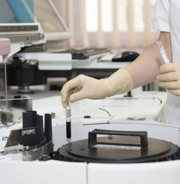 Blood Test to Detect 7 Most Dangerous Cancers