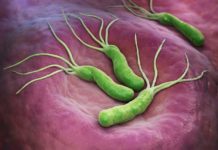 How to Get Rid of Helicobacter Pylori?