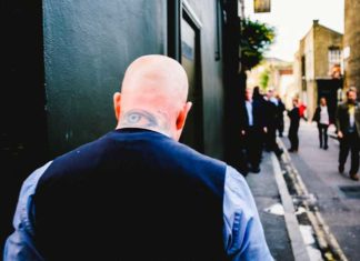 3D Printing to Stop Hair Loss