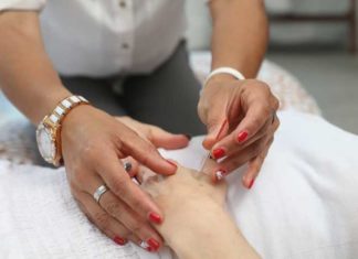 Acupuncture Myths & Facts