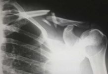 Ultrasound and X-Ray Alternatives Created