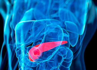 Pancreatic Cancer to Be Treated with Modified Smallpox Virus