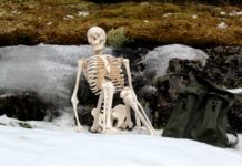 Why Do My Joints Snap?