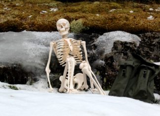 Why Do My Joints Snap?