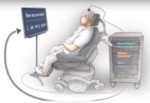 Paralyzed Patient Can Communicate Again Due to This Neuroprosthesis