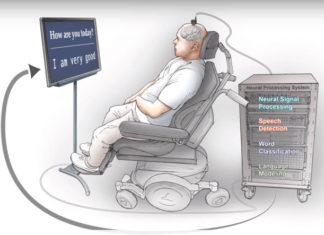 Paralyzed Patient Can Communicate Again Due to This Neuroprosthesis