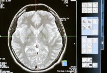 Remote Brain Surgery Made Possible