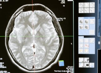 Remote Brain Surgery Made Possible