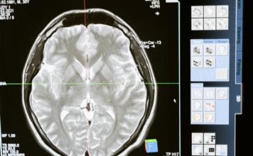 Remote Brain Surgery Made Possible
